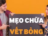Chữa bỏng bằng đồ có sẵn trong bếp 